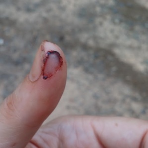 Cut finger at Petit Jean State Park